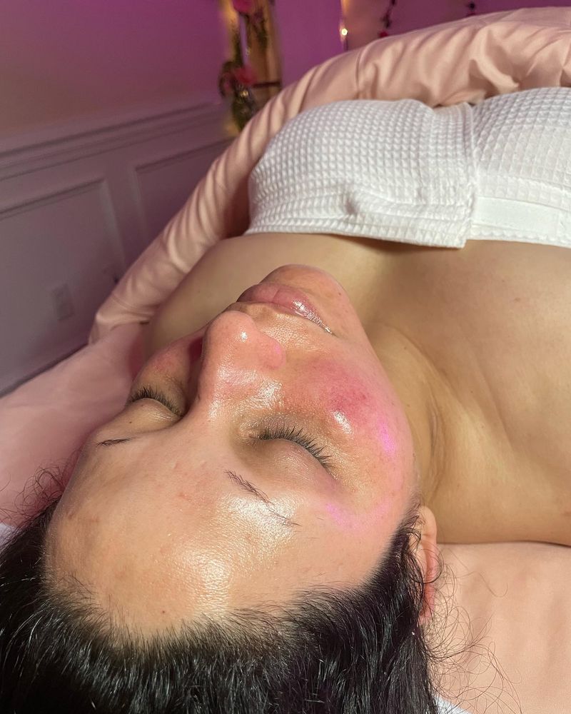 Microdermabrasion for Luxury Aesthetics Spa in Savannah, Georgia