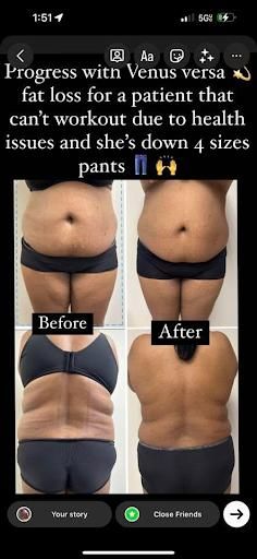 Post Operation Therapy for Royal Villa Houston in Houston, TX