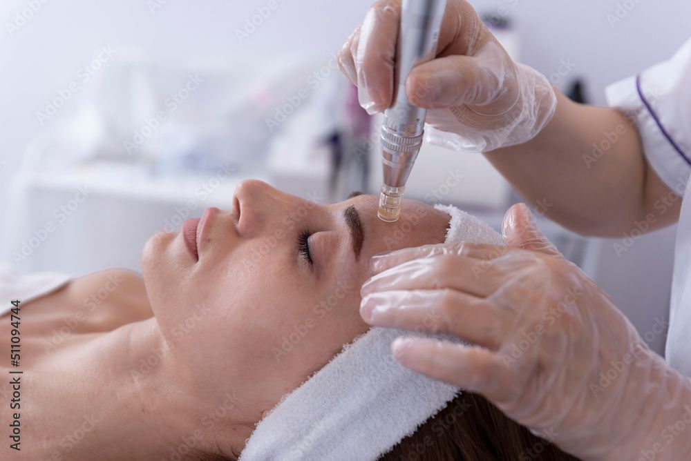 Microneedling is a minimally invasive procedure that uses fine needles to create tiny punctures in the skin, stimulating collagen production and enhancing skin texture. It helps improve the appearance of scars, wrinkles, and stretch marks, promoting smoother, firmer skin. for Royal Villa Houston in Houston, TX