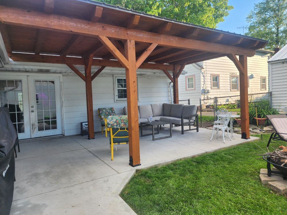 Custom Pergolas and  Gazibos for Providence Home Improvement  in Fort Wayne, IN