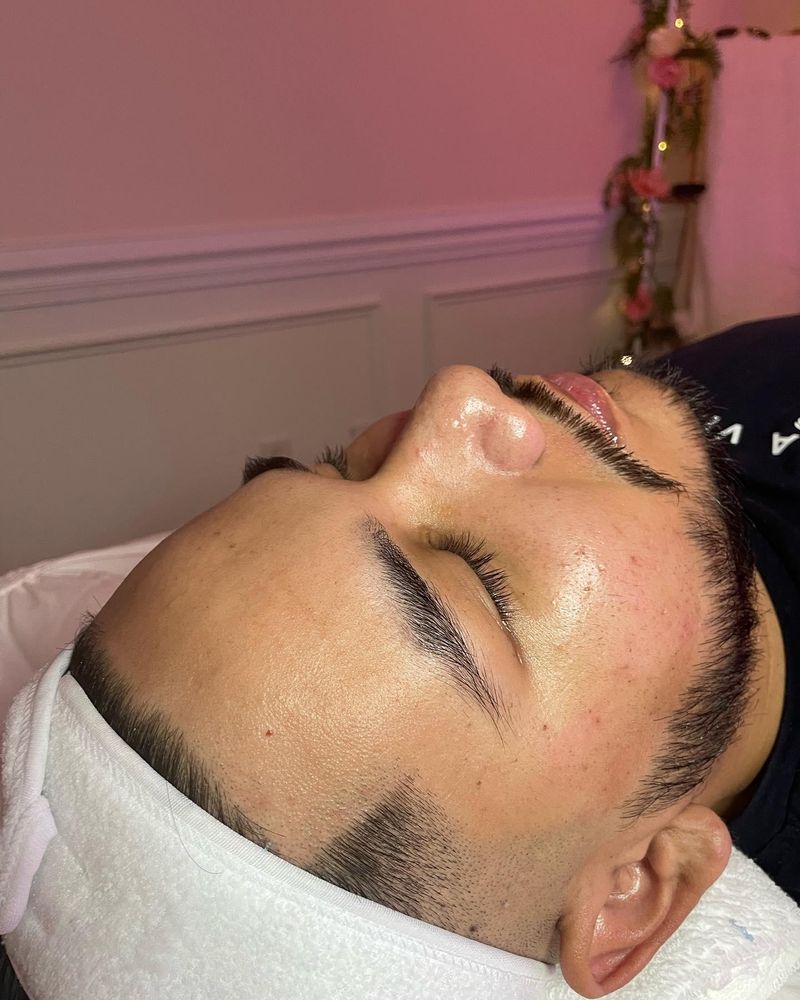 Microdermabrasion for Luxury Aesthetics Spa in Savannah, Georgia