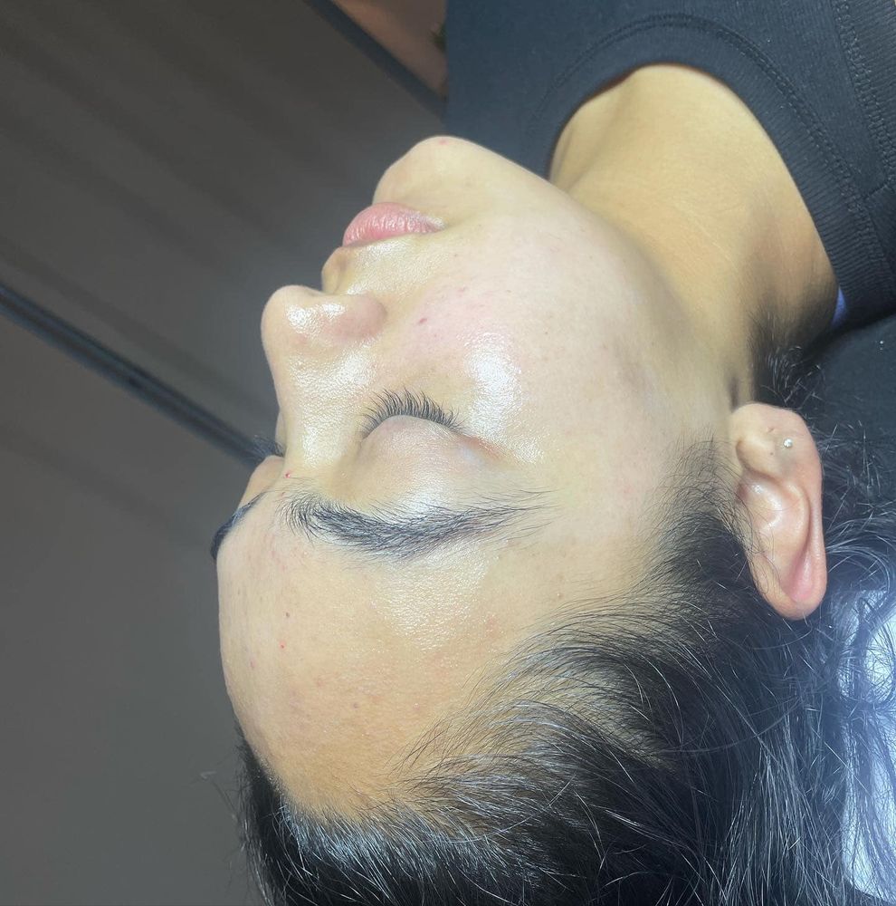 Microdermabrasion for Luxury Aesthetics Spa in Savannah, Georgia