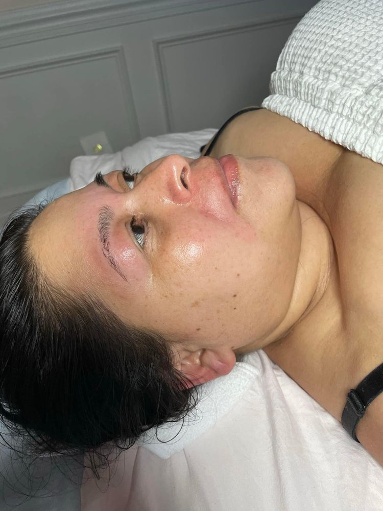 Microdermabrasion for Luxury Aesthetics Spa in Savannah, Georgia