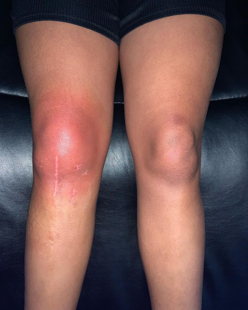 All Photos for Arctic Cryotherapy Bayonne in Bayonne, NJ