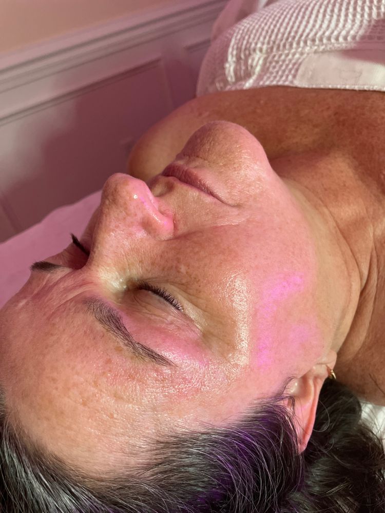 Microdermabrasion for Luxury Aesthetics Spa in Savannah, Georgia