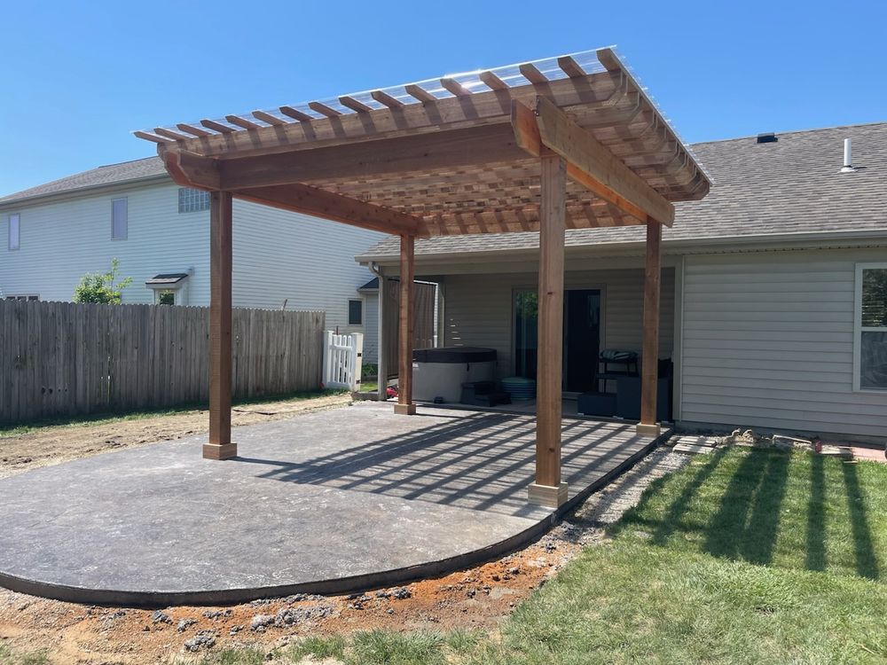 Custom Pergolas and  Gazibos for Providence Home Improvement  in Fort Wayne, IN