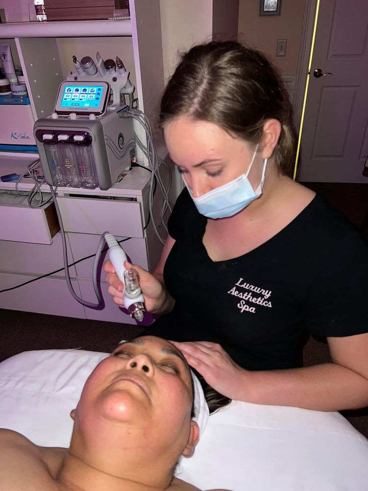 Microdermabrasion for Luxury Aesthetics Spa in Savannah, Georgia