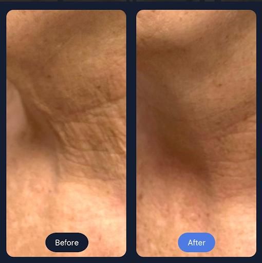 All Photos for Arctic Cryotherapy Bayonne in Bayonne, NJ