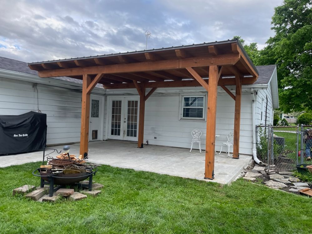 Custom Pergolas and  Gazibos for Providence Home Improvement  in Fort Wayne, IN