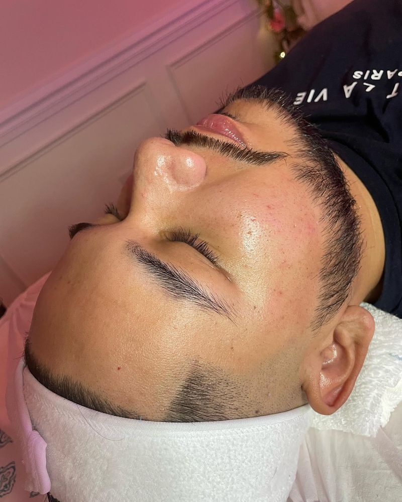 Microdermabrasion for Luxury Aesthetics Spa in Savannah, Georgia