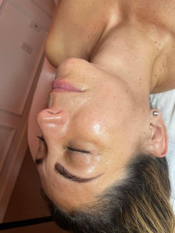 Microdermabrasion for Luxury Aesthetics Spa in Savannah, Georgia