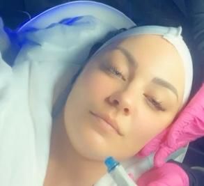 Hydrafacial for Royal Villa Houston in Houston, TX