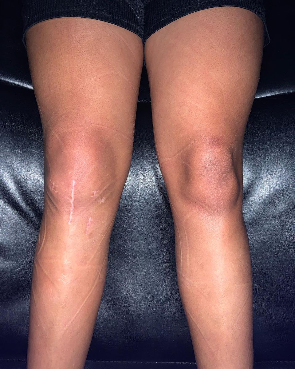 Local Cryotherapy for Arctic Cryotherapy Bayonne in Bayonne, NJ