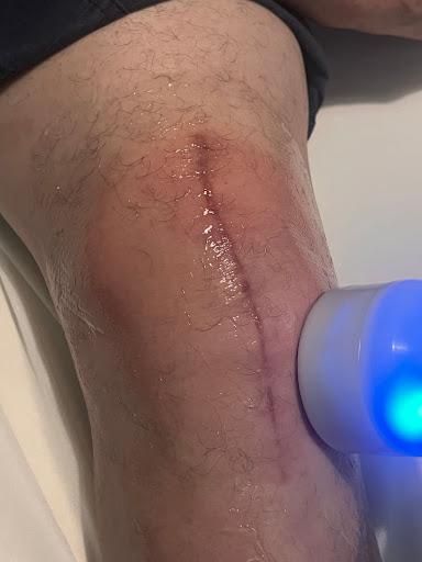 Local Cryotherapy for Arctic Cryotherapy Bayonne in Bayonne, NJ