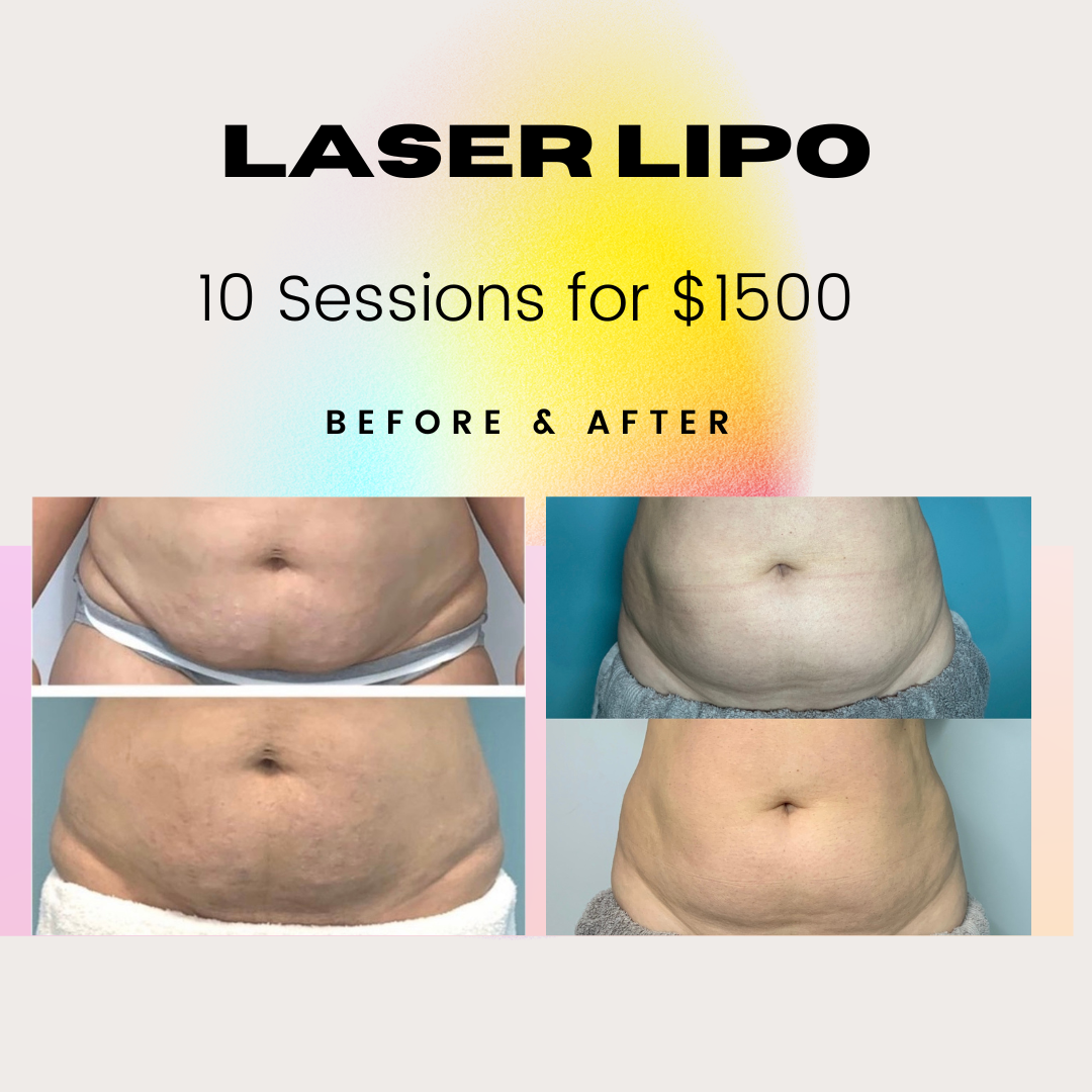 Shop All for Arctic Cryotherapy Bayonne in Bayonne, NJ