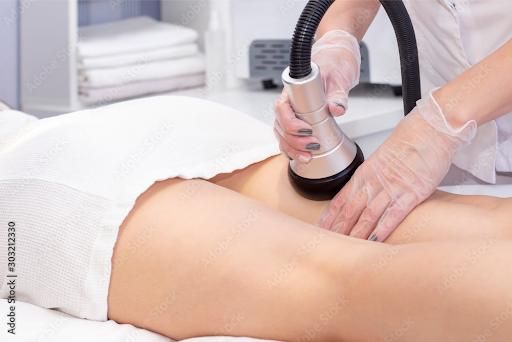 Bodysculpting