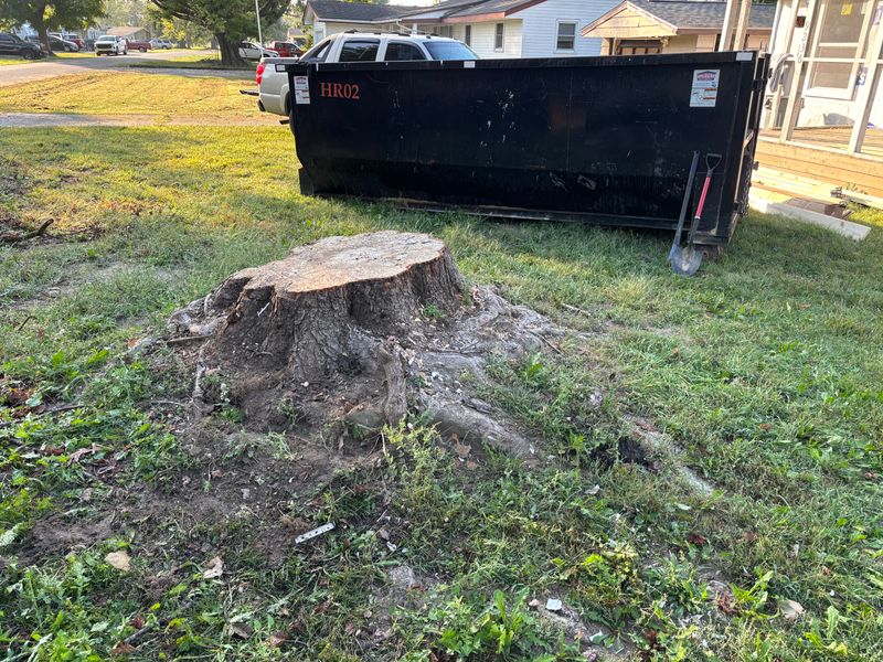 Stump Removal