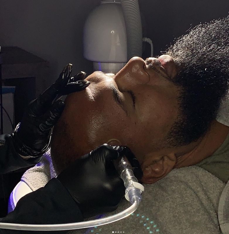 PRP Skin/Scalp