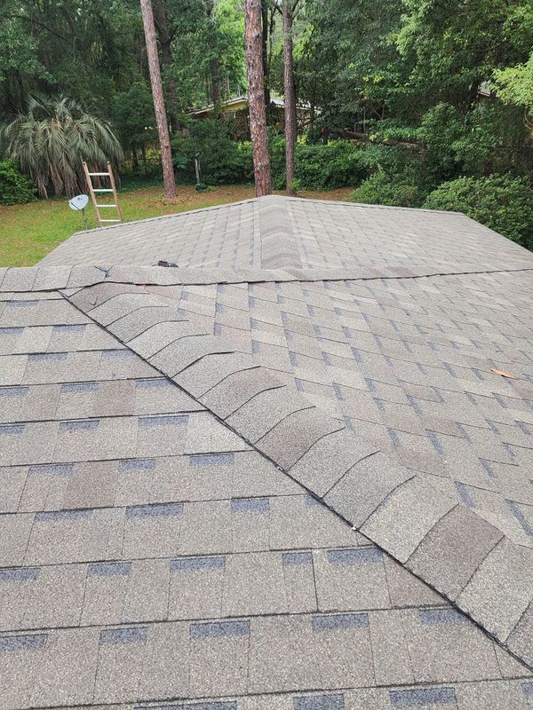 Shingles