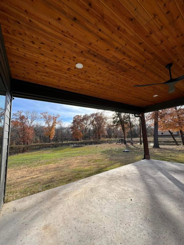 Remodel; Kennedi