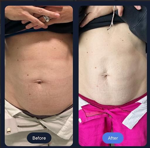  for Arctic Cryotherapy Bayonne in Bayonne, NJ