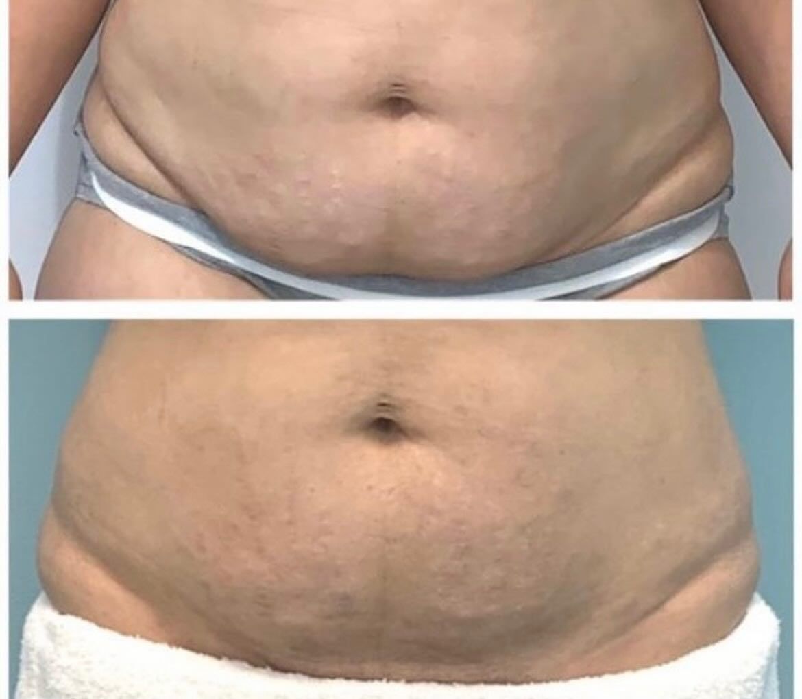  for Arctic Cryotherapy Bayonne in Bayonne, NJ