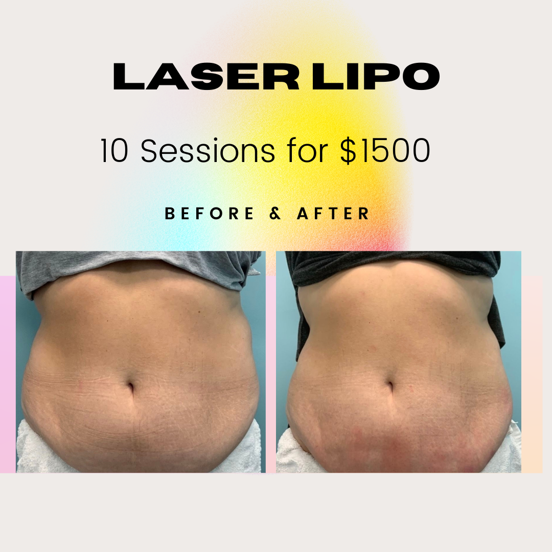  for Arctic Cryotherapy Bayonne in Bayonne, NJ