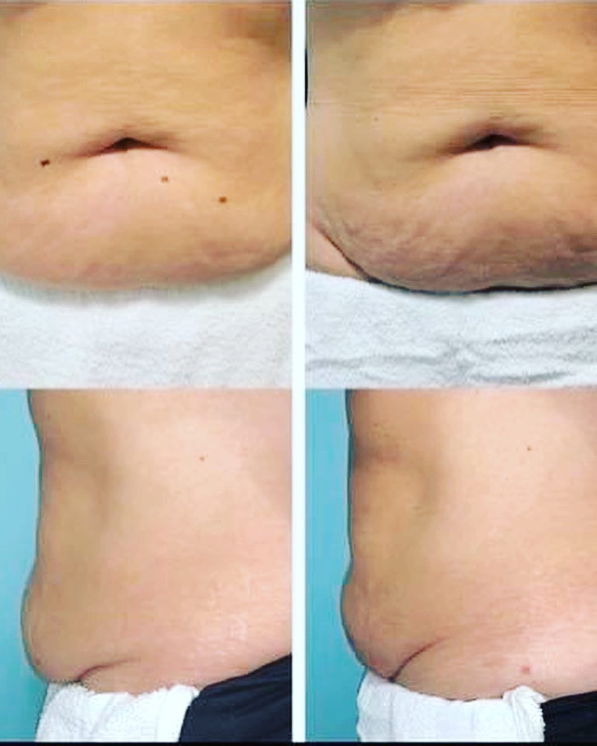  for Arctic Cryotherapy Bayonne in Bayonne, NJ