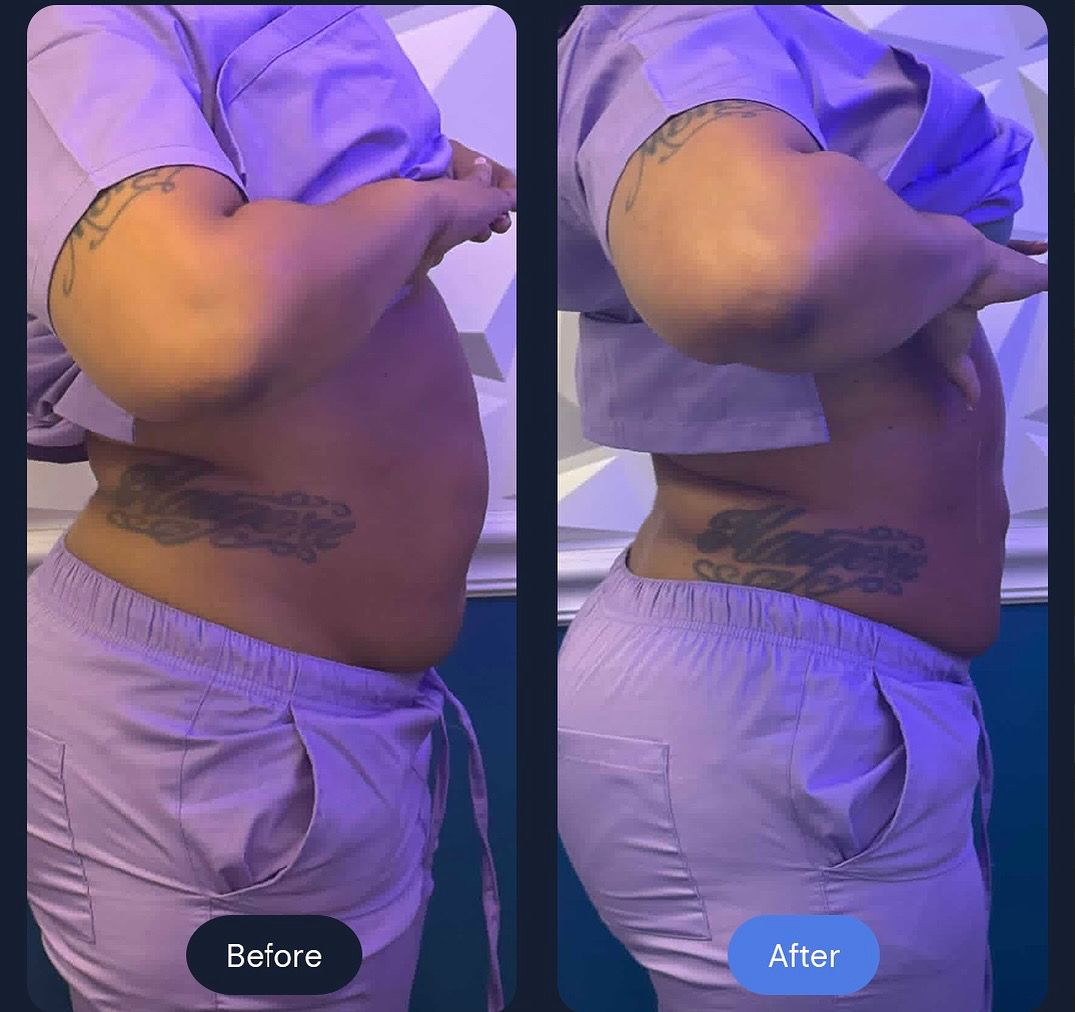  for Arctic Cryotherapy Bayonne in Bayonne, NJ