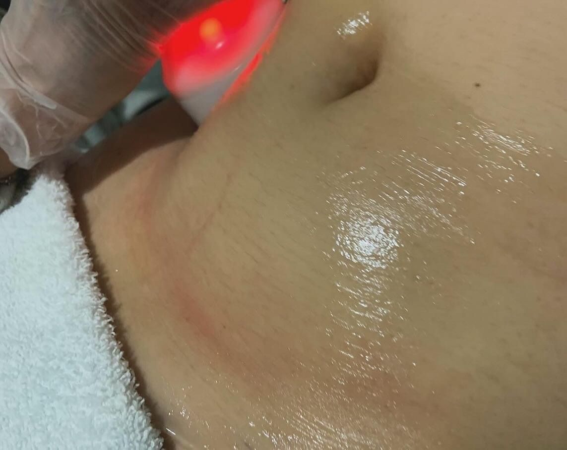 for Arctic Cryotherapy Bayonne in Bayonne, NJ