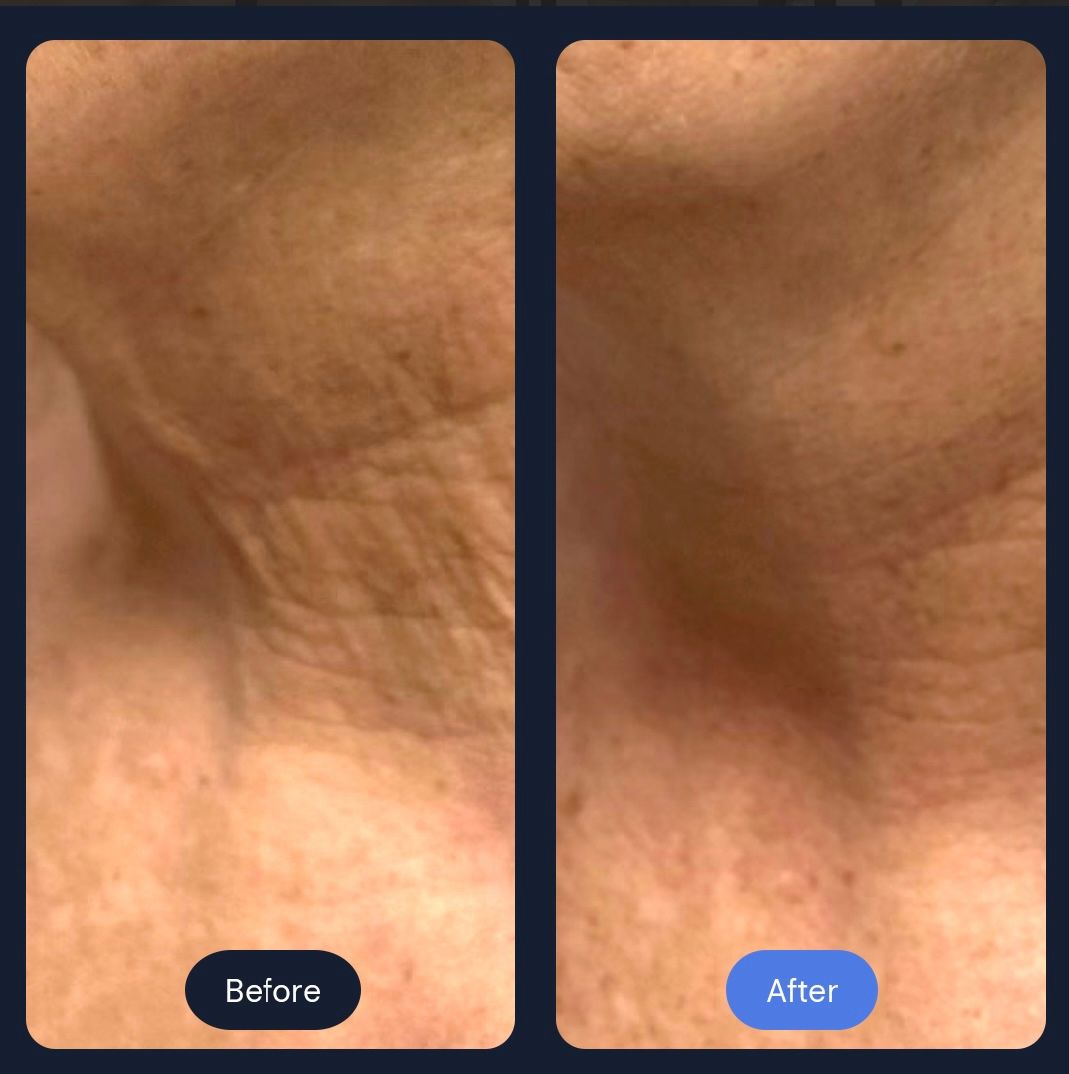  for Arctic Cryotherapy Bayonne in Bayonne, NJ