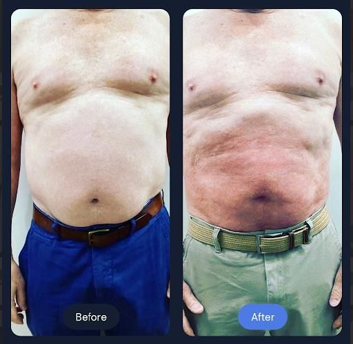  for Arctic Cryotherapy Bayonne in Bayonne, NJ